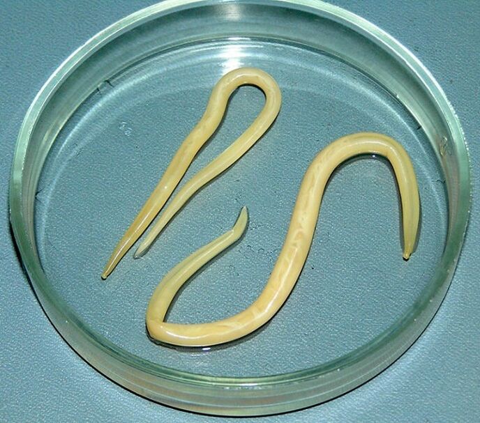 паразит червей от човешкото тяло
