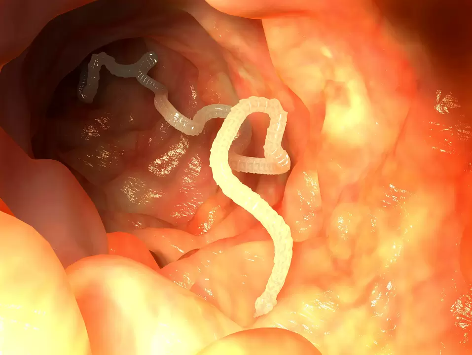 човешки хранопровод паразитен червей