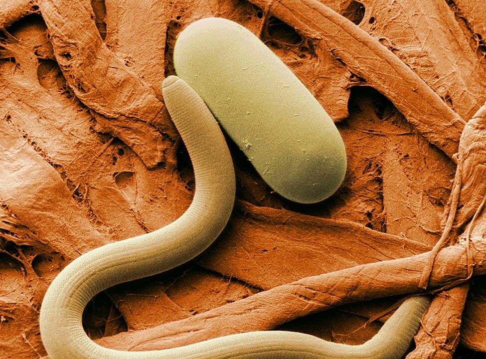 как се случва заразяването с червеи